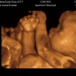 34-Weeks-Pregnant-Ultrasound-Picture