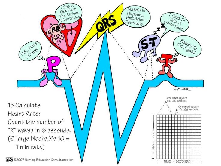 ECG